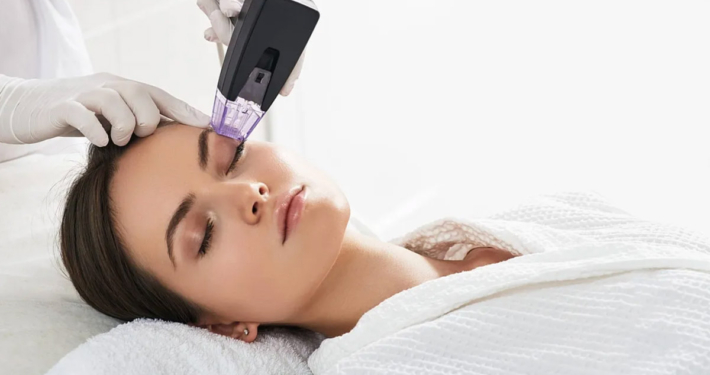 A woman receiving morpheus 8 treatment in Deerfield Beach FL